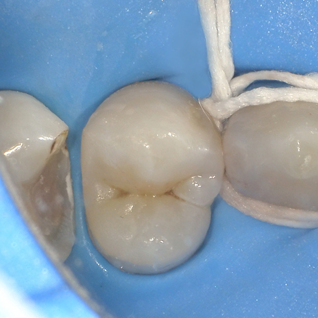 Case2_治療過程