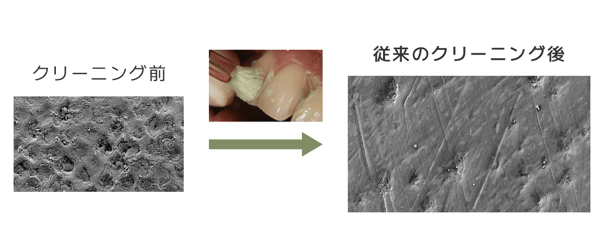クリーニング前と従来のクリーニング後