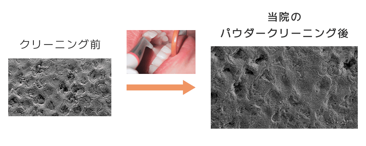 クリーニング前と従来のクリーニング後