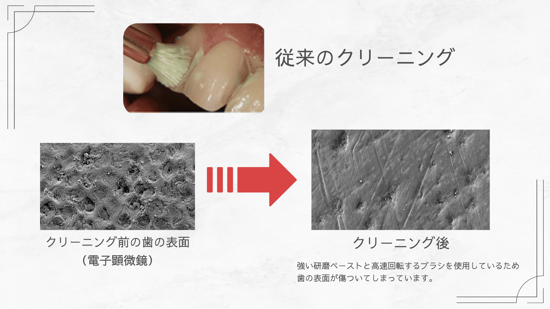 クリーニング前後比較