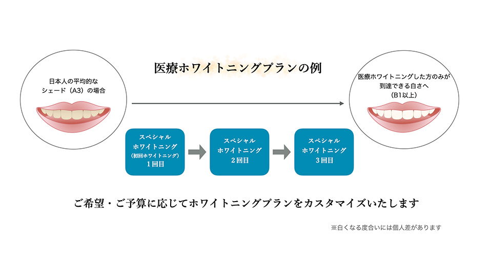 模式図